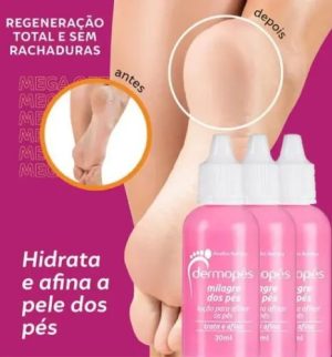 Loção para afinar os pés Milagre dos pés Dermopés Abelha Rainha, 30ml